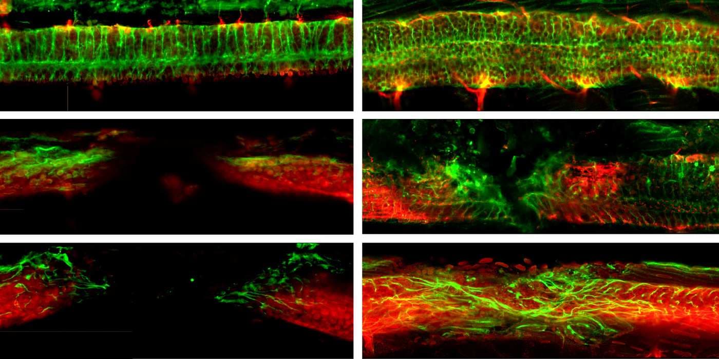 Mouse with Severed Spinal Cord Recovers ‘Normal’ Movement After Potentially Revolutionary Treatment